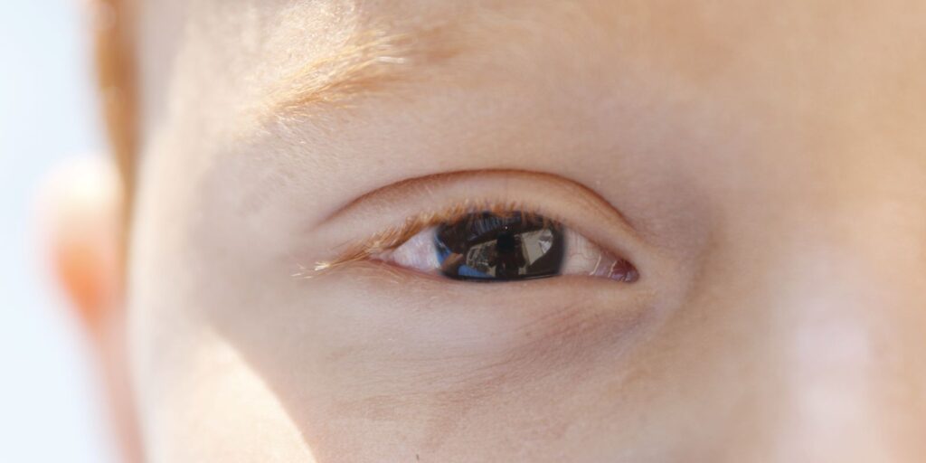 Erros de refração são principal causa de deficiência visual infantil erros-de-refracao-sao-principal-causa-de-deficiencia-visual-infantil