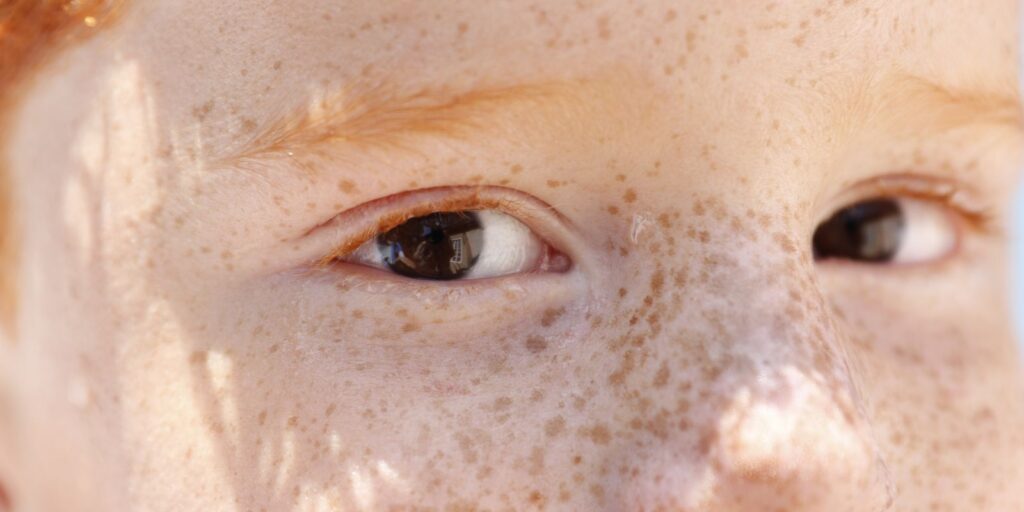 Reflexo branco nos olhos: entenda condição que assusta pais reflexo-branco-nos-olhos:-entenda-condicao-que-assusta-pais