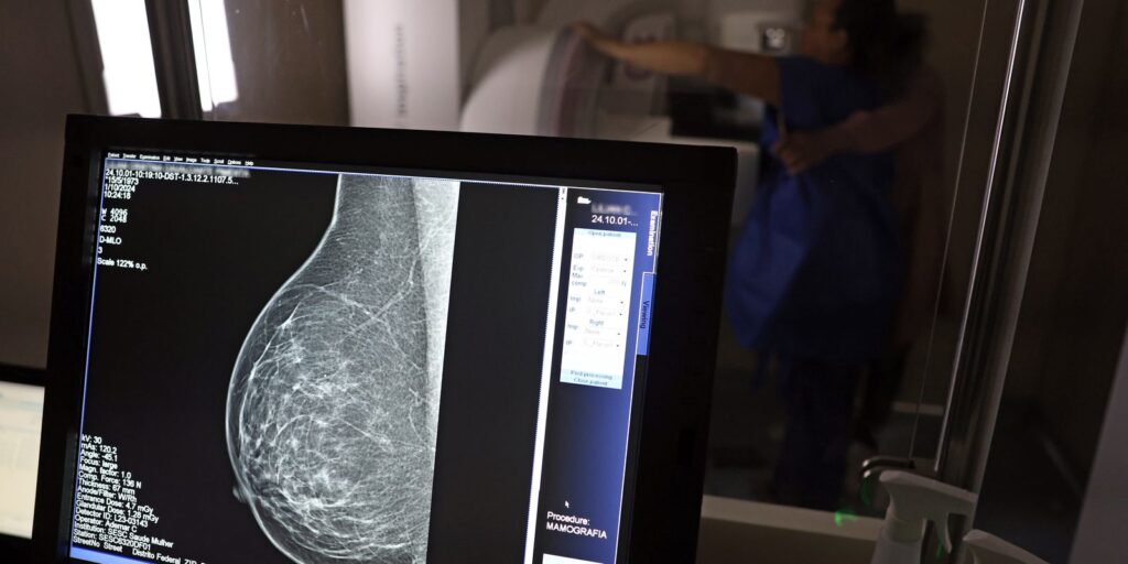 outubro-rosa-reforca-diagnostico-precoce-de-cancer-de-mama